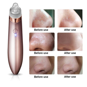 Blackhead Remover Vacuum Acne Cleaner Black Spots Removal